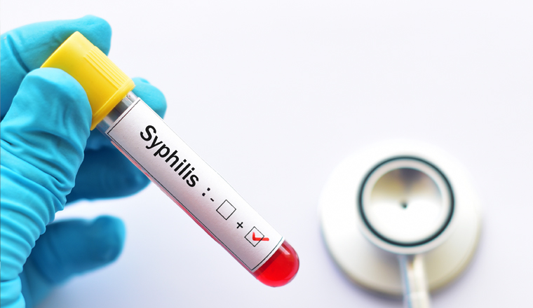 Hand wearing blue glove holding a blood sample which states positive to syphilis