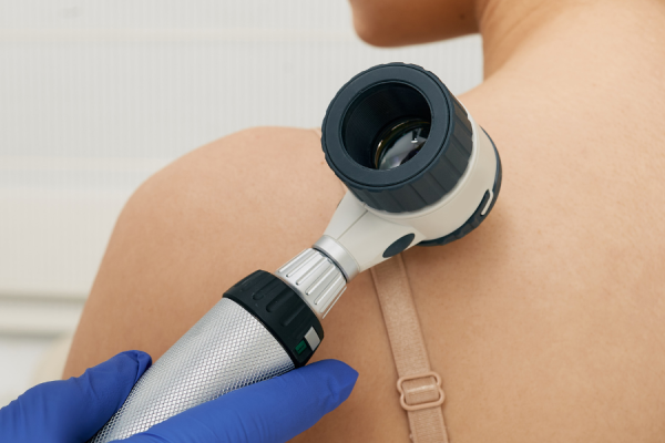A magnifying scope on a woman's shoulder
